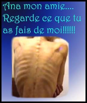 La lutte contre les site pro ana